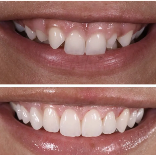 before and after photo