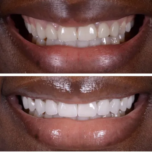 before and after photo