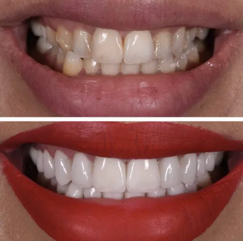 before and after photo